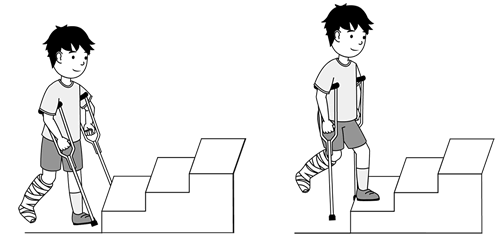 To go up stairs, place weight on your good leg then bring up your crutches and injured leg.